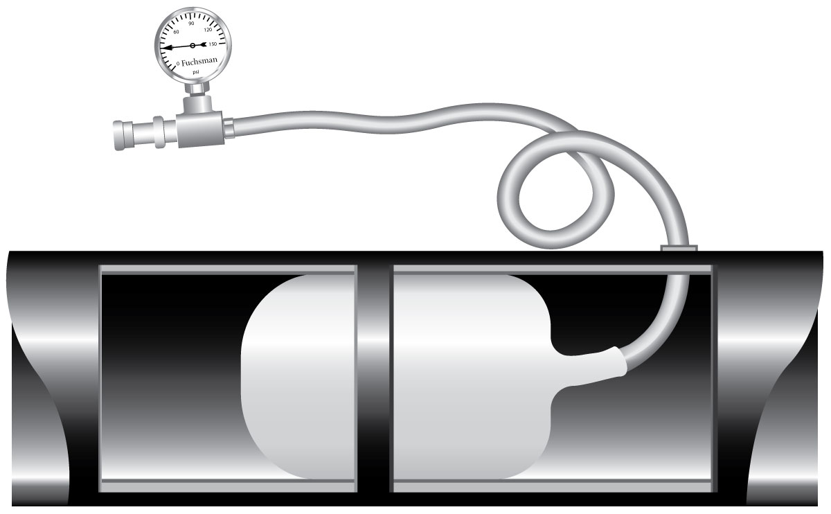 Inflatable-Balloon-Plug-White-Plug-3 Inflatable-Balloon-Plug-White-Plug-3